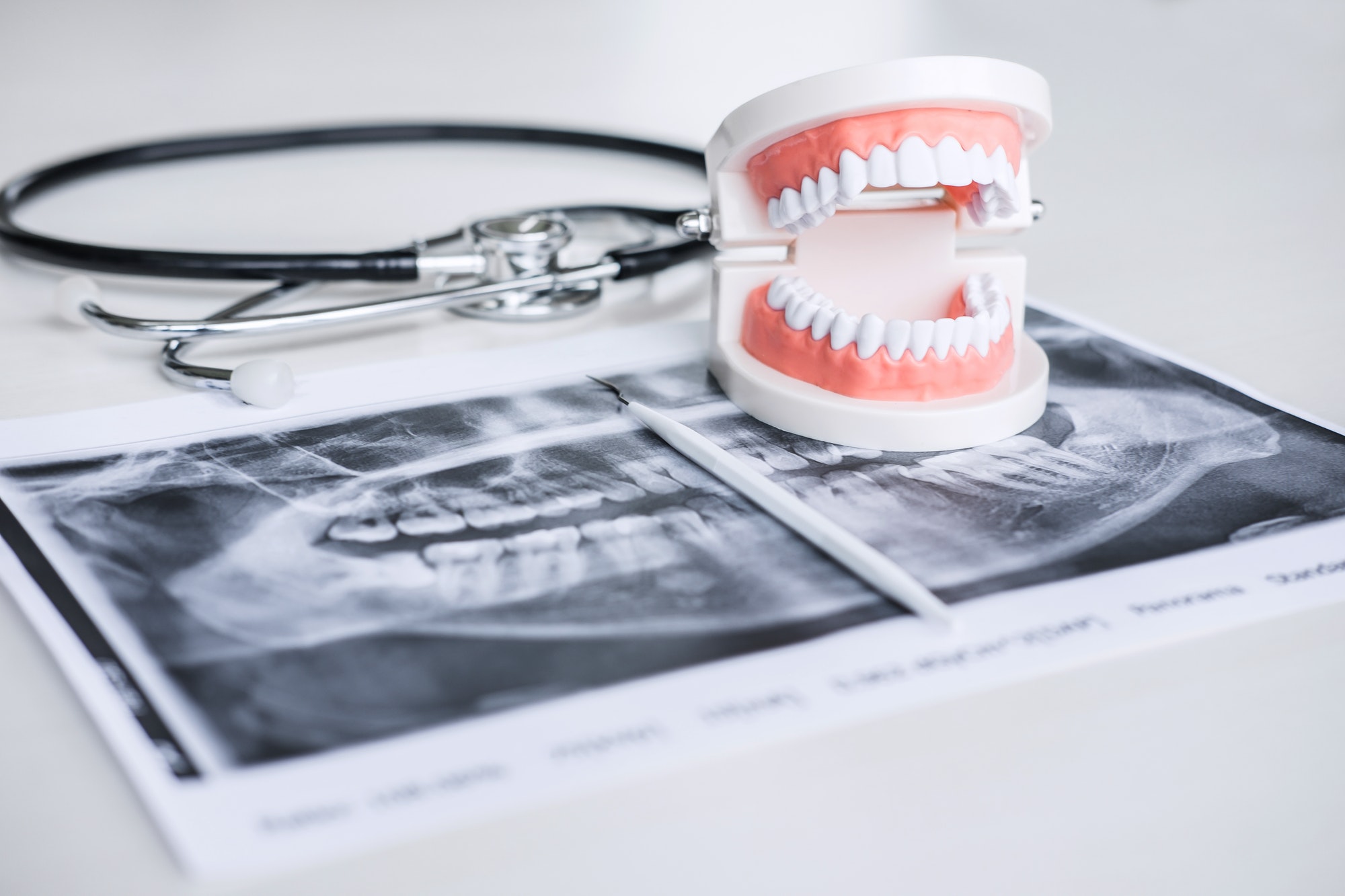 Dental model and equipment on tooth x-ray film and stethoscope used in the treatment of dental and
